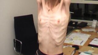 anorexic Suse 8t00587