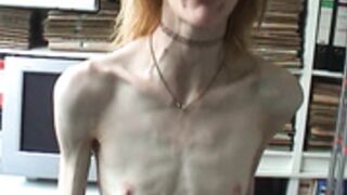 anorexic Suse & Annette