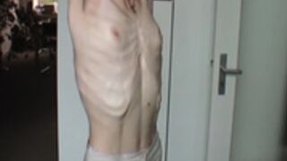 anorexic Suse 8t00598