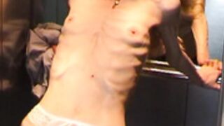 anorexic Suse 8t00598