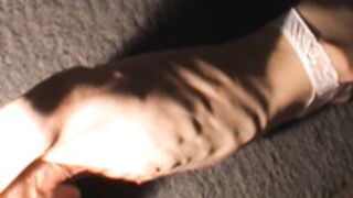 anorexic Suse 8t00598