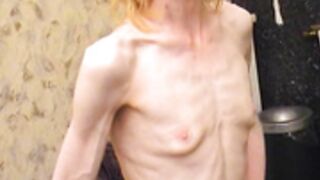 anorexic Suse & Andrea 8t00411