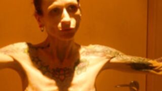 anorexic Patricia 8t00647