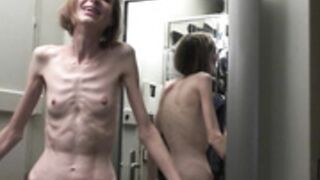 anorexic Sonja 8t00350