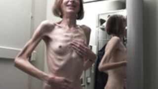 anorexic Sonja 8t00350