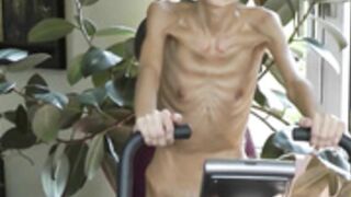 anorexic Denisa 8t00440