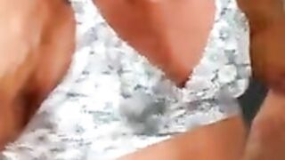 fbb vein explosion
