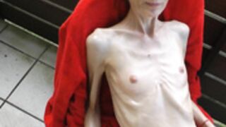 anorexic Denisa 8t00516