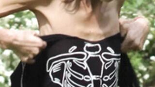 anorexic Denisa outdoors 8t00448