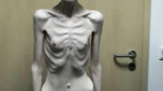 anorexic Stasha 8t00338