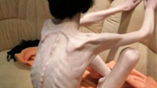 anorexic Stasha 8t00338