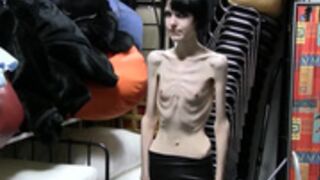 anorexic Stasha 8t00336
