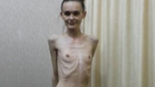 anorexic Denisa 8t00528
