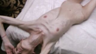 anorexic Denisa 8t00520