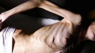anorexic Denisa 8t00030