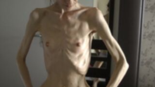 anorexic Denisa 8t00062