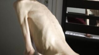 anorexic Denisa 8t00062