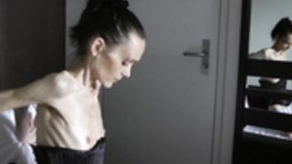 anorexic Denisa 8t00062