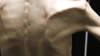 anorexic Denisa 8t00058