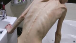 anorexic Denisa 8t00058