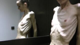 anorexic Denisa 8t00052
