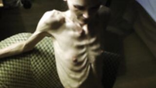 anorexic Denisa 8t00052