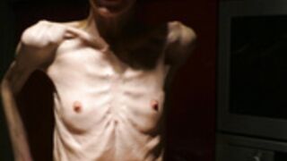 anorexic Denisa 8t00090