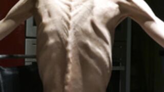 anorexic Denisa 8t00090