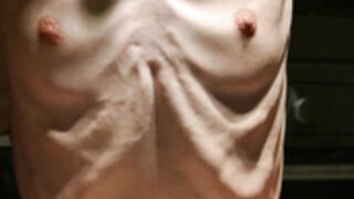 anorexic Denisa 8t00090