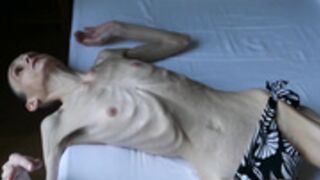 anorexic Denisa 8t00082