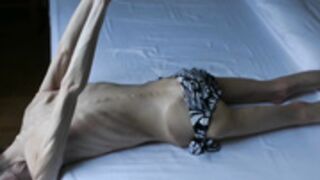 anorexic Denisa 8t00082