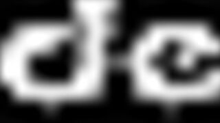 hourglass expansion tmc