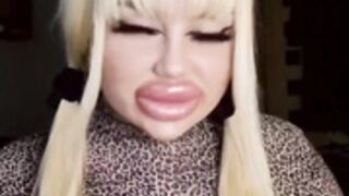 Incredible Huge fake lips!!!