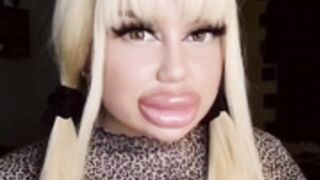 Incredible Huge fake lips!!!