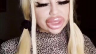 Incredible Huge fake lips!!!
